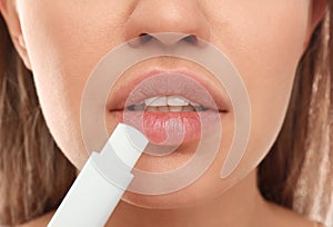 Young woman with cold sore applying lip balm photo