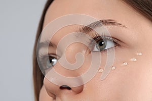 Young woman with cream around eye on light grey background, closeup