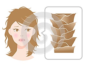 young woman with damaged hair cuticles illustration. hair care and beauty concept