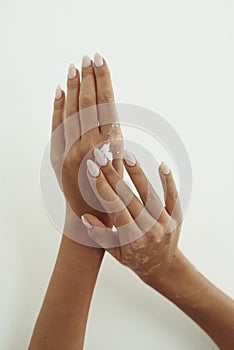 Young woman distributes hand cream on her hands. The concept of skin hydration, hand care and wrinkle prevention