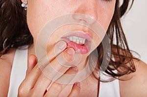 Young woman examining herpes in her face