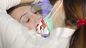 Young woman with an expander in mouth at the dental clinic. Application of protective whitening gel to the teeth.