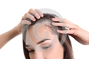 Young woman with hair loss problem on white background