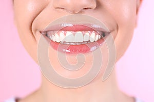 Young woman with healthy teeth and beautiful smile on color background