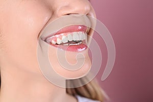 Young woman with healthy teeth and beautiful smile on color background, closeup.