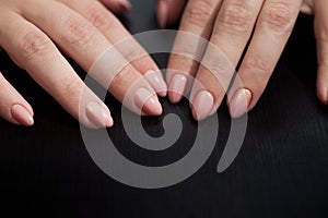 Young woman palms on black background. Close up. Beautiful Glamorous Manicure.