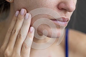 Young woman with a problem dry skin and with big pores.