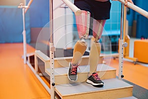 Young woman with prosthetic legs exercising at physiotherapy center