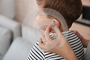 Young woman putting hearing aid in little son`s ear, closeup