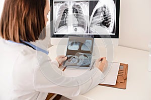 Young woman radiologist doctor analysis x-ray