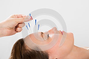 Young Woman Receiving Acupuncture Treatment