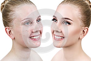 Young woman before and after retouch.