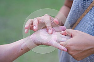 A young woman`s hand is touching a lump of flesh up the middle of the palm of a senior woman. The lump is abnormal