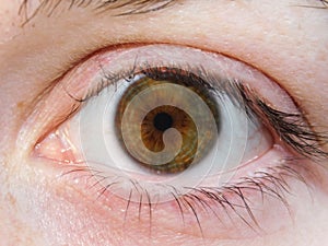 Young woman`s hazel eye with visible nerve rings.