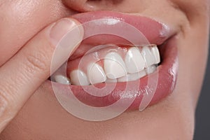 Young woman showing healthy gums, closeup view