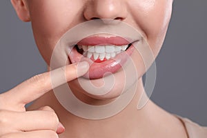 Young woman showing inflamed gums on grey background, closeup