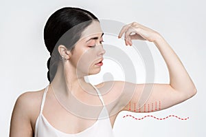 A young woman shows her hand, with sagging skin. White background. The concept of excess weight and weight loss