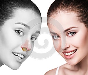 Young woman with stuffiness before and after treatment.