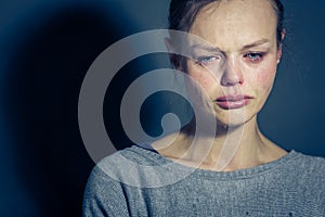 Young woman suffering from severe depression/anxiety/sadness
