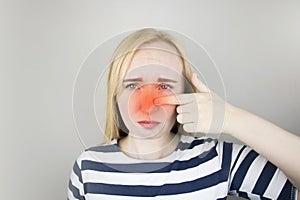 A young woman touches her nose, which is very painful. Medical care concept for difficulty breathing, clogged nasal passages and