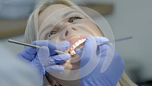 Young woman is undergoing dental examination. Close-up view. Slow motion