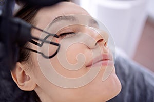 young woman undergoing laser resurfacing and peeling procedure photo