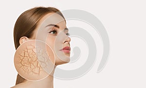 Young woman with zoom circle of dry facial skin before moistening  on white background. Skincare, healthcare