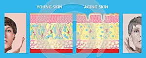 Younger skin and aging skin. elastin and collagen. photo