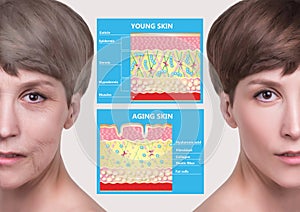 Younger skin and aging skin. elastin and collagen.