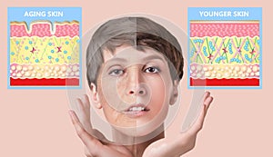 Younger skin and aging skin. elastin and collagen. photo