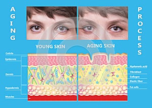 Younger skin and aging skin. elastin and collagen.