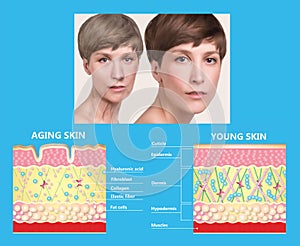 Younger skin and aging skin. elastin and collagen. photo