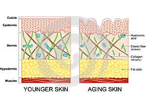 Younger skin and older skin