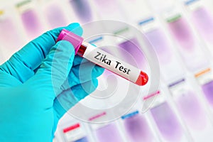 Zika virus