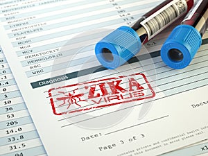 Zika virus diagnosis. Blood test sample with Zika virus stamp,