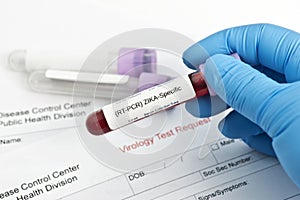 Zika Virus Lab Test