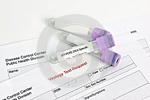 Zika Virus Lab Test