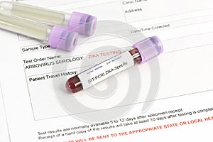 Zika Virus Lab Test