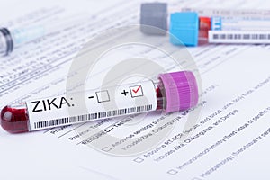 Zika Virus Lab Test form