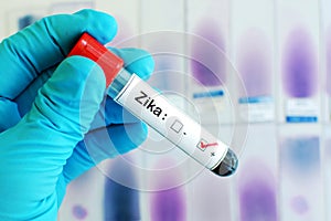 Zika virus positive