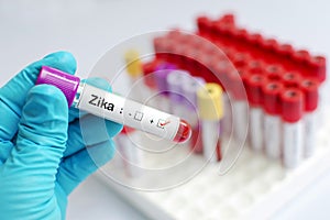 Zika virus positive