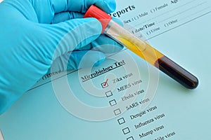 Zika virus test