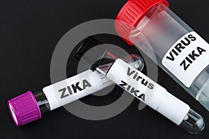 Zika virus and test tube