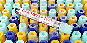 ZIKA virus - test tubes, blood tests - 3D illustration
