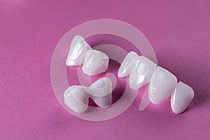 Zircon dentures on a pink background - Ceramic veneers - lumineers photo