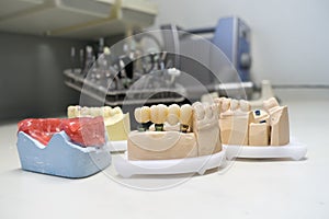 Zirconia dental crowns on dental models