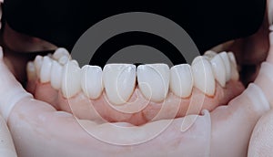 10 Zirconium crown. Dental health care. Zirconium crowns in final version. Staining and glazing. Precision design and photo