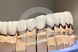 Zirconium Porcelain Tooth plate photo