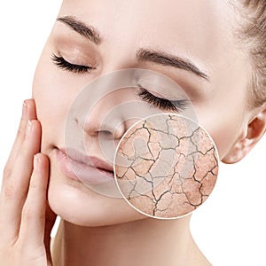 Zoom circle shows dry facial skin before moistening.