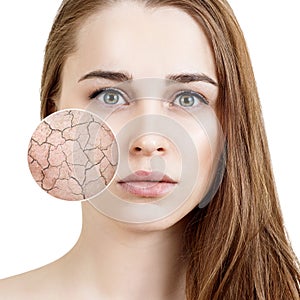 Zoom circle shows dry facial skin before moistening.